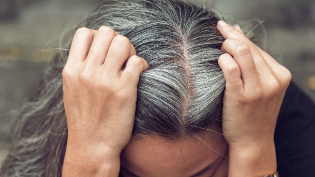 Are stress and graying related?  Latest Research