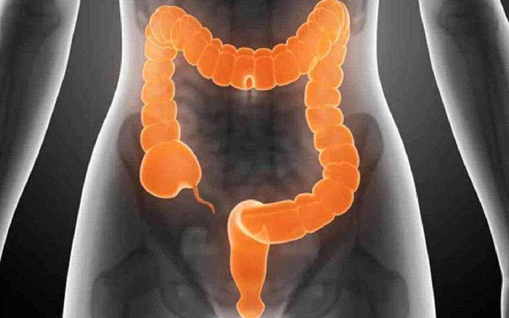 If you suffer from Irritable Bowel Syndrome and over the age of forty, you should not eat these foods