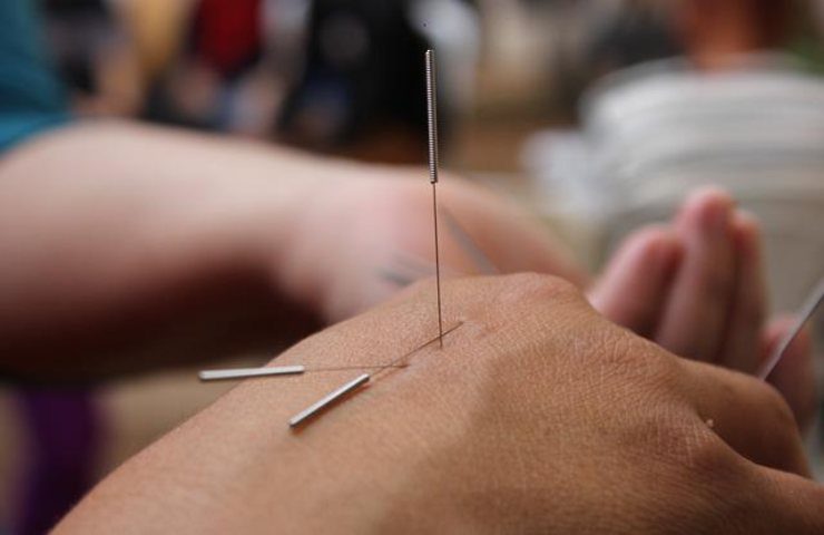 treatment needles 